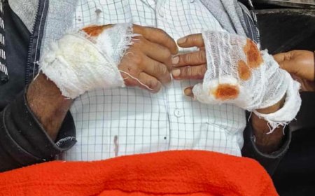 দুর্গাপুরে জমি জমার জেরে সংঘর্ষ , আহত ২